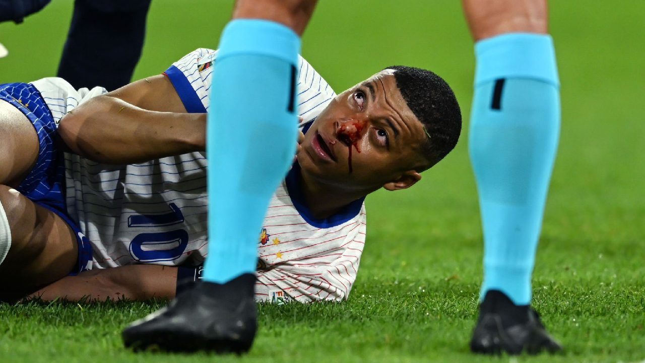  Fracture du nez de Kylian Mbappé, l'annonce officielle de la France est tombée