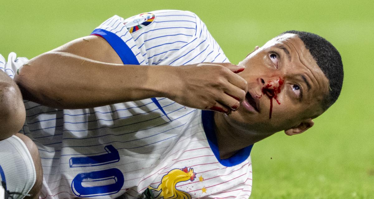 Euro 2024 : La grosse révélation sur la blessure de Kylian Mbappé